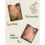 NIACINAMIDE + ZINCO | LA SAPONARIA - immagine 5